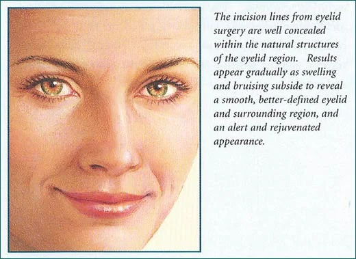eyelid surgery eyelid surgery