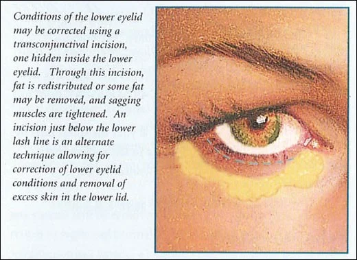 eyelid eyelid
