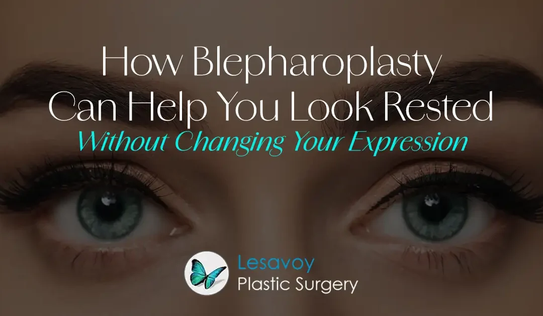 How Blepharoplasty Can Help You Look Rested