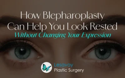 How Blepharoplasty Can Help You Look Rested